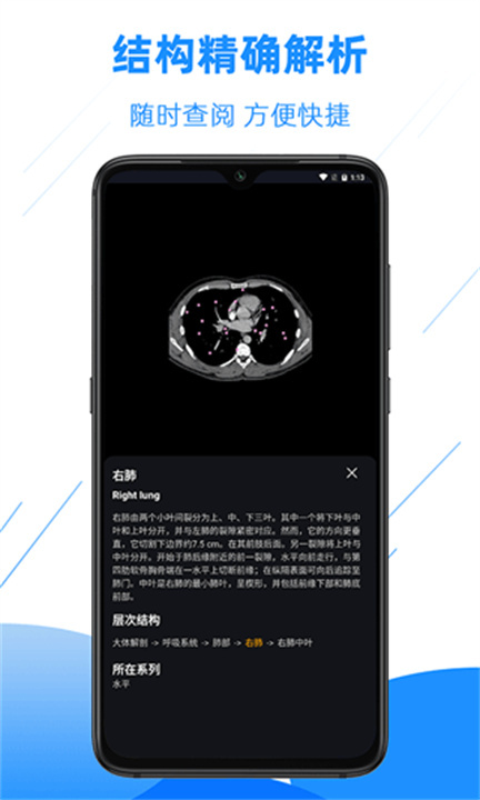 影像解剖图谱截图